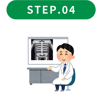 STEP.04